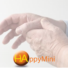 Safety and Predictive Factors of Short-Term Efficacy of a Single Injection of Mannitol-Modified Cross-Linked HA in Patients with Trapeziometacarpal OA. Safety and Predictive Factors of Short-Term Efficacy of a Single Injection of Mannitol-Modified Cross-Linked HA in Patients with Trapeziometacarpal OA.